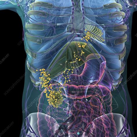 Cancer Metastasis Illustration Stock Image C0404156 Science