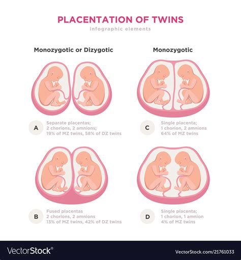 Twin Types Infographic Elements In Flat Design Vector Image