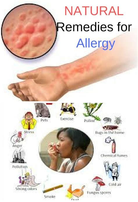 Pin By Ada On Random Allergy Remedies Cure For Allergies Natural