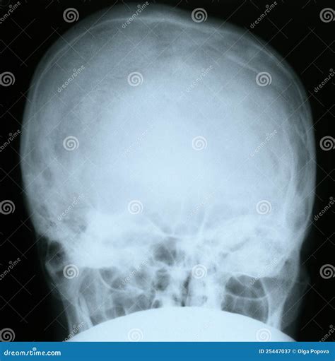 X Ray Of A Human Skull Stock Image Image Of Photograph 25447037