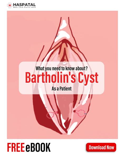 How Bartholin S Cyst Can Affect Your Health Haspatal Online