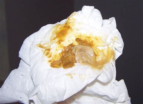 We did not find results for: Help Indentifying: Photo Of Parasite On My Toilet Paper ...