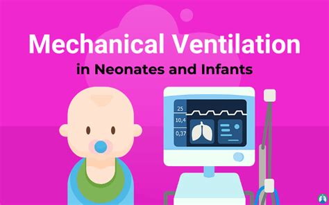 The Procedure For Initiating Mechanical Ventilation In Neonates And