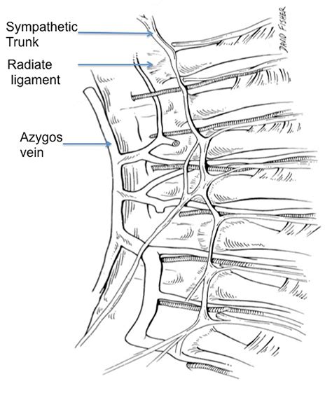 Cureus Ligaments Of The Costovertebral Joints Including Biomechanics