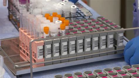 Documents Show Major Labs Coronavirus Tests Took Days Longer Than