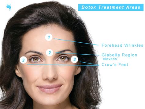 Glabella Treatments Using Botox At My Face Aesthetics Clinic Bolton