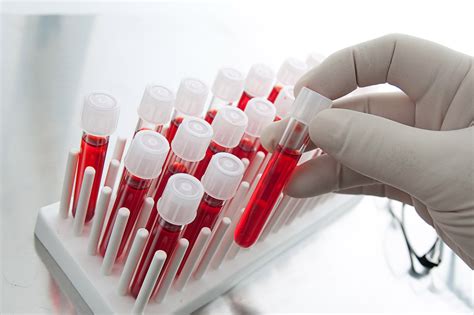 The Benefits Of Blood Testing For Performance Athletic Lab