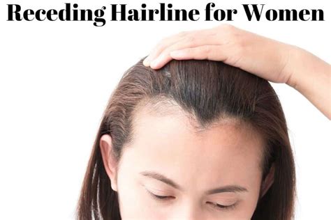 Receding Hairline For Women Tips For Regrowing A Hair Back Haircuts