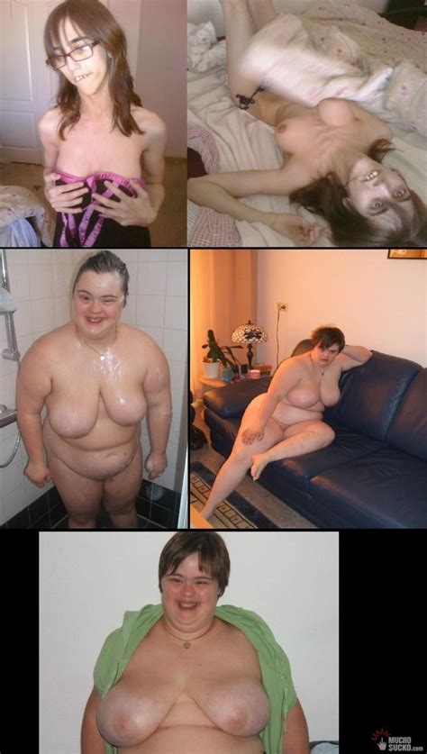 Down Syndrome Retarded Girl Nude