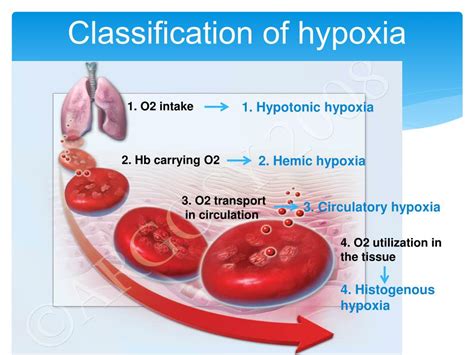Ppt Hypoxia Powerpoint Presentation Free Download Id5655356