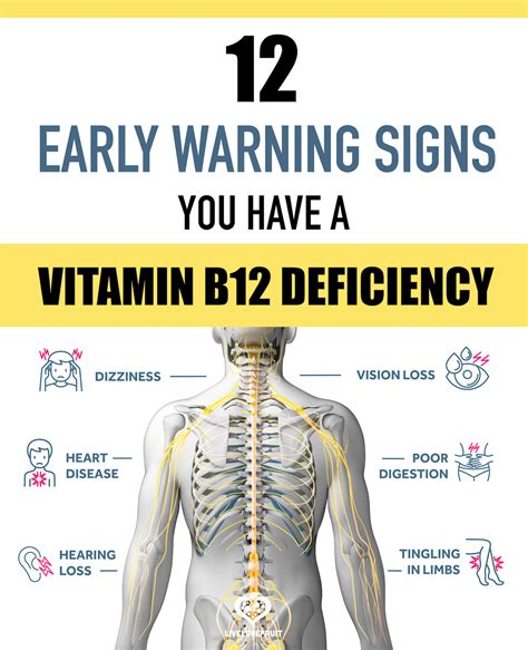 Vitamin B12 Deficiency Expertsguys