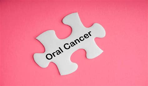 Oral Cancer Vs Canker Sore How To Determine Whether A Condition Is