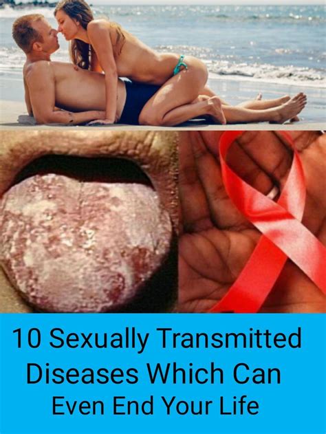 10 Sexually Transmitted Diseases Which Can Even End Your Life With