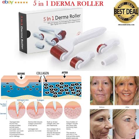 5 In 1 Derma Roller Skin Therapy Micro Needle Titanium Microneedle