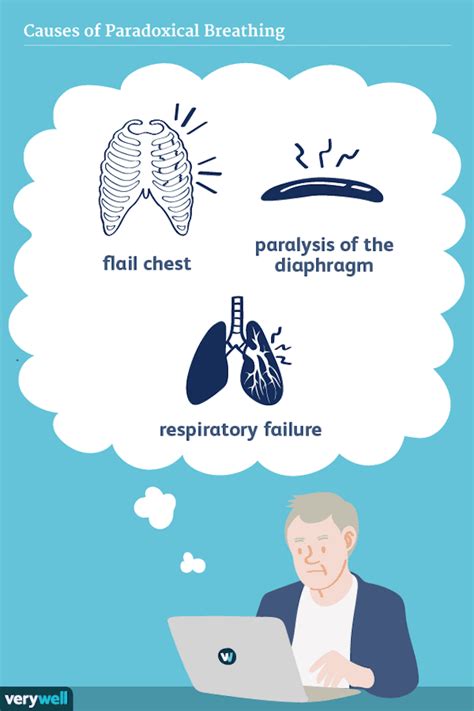 Paradoxical Breathing Symptoms Causes And Treatment