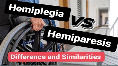 Hemiplegia Vs Hemiparesis Understanding The Differences Similarities