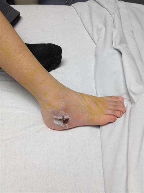 They may arise from the bone tissue, and we call them primary bone tumors. Tristan, Bone Cancer's got nothing on "U": Hospital