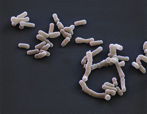 Bifidobacterium Breve Sem Photograph By Meckesottawa Fine Art America
