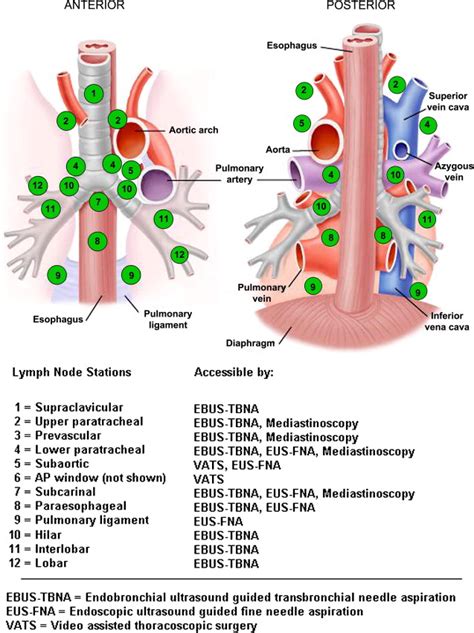 Mediastinal Lymph Node Station