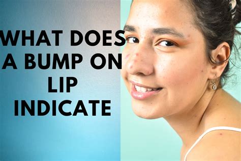 What Does A Bump On Lip Indicate What Causes Them How To Cure Them