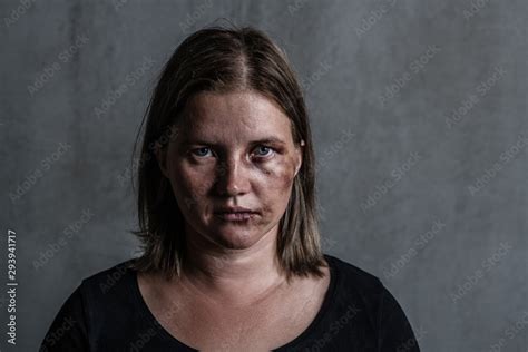 Portrait Of The Woman Victim Of Domestic Violence And Abuse 素材庫相片