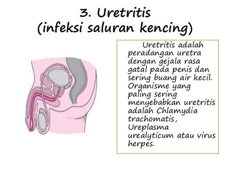 Penyakit Pada Sistem Reproduksi Homecare24