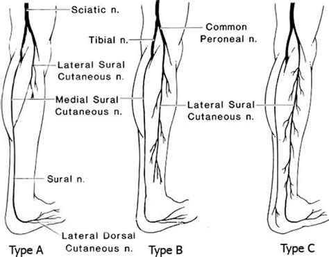 The Types Of The Formation Of The Sural Nerve Sn Type A Anastomotic