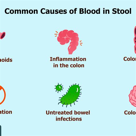 What Color Is The Blood In Your Stool If You Have Colon Cancer