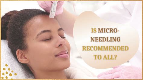 Is Microneedling Recommended To All Derma Roller Treatment In