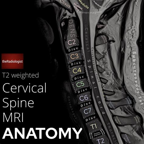 Cervical Spine MRI Anatomy Sagittal T2 Weighted By GrepMed