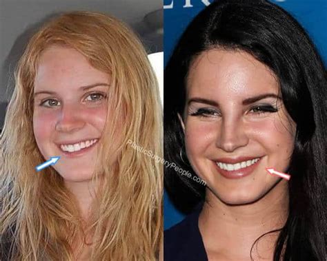 Lana Del Rey Before She Was Famous
