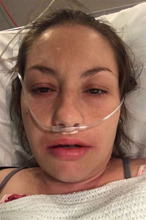 Uk Mom Lost Part Of Ear Almost Died After Getting Sepsis