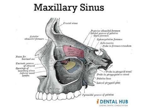 Pressure In Right Maxillary Sinus With Images Maxillary Sinus