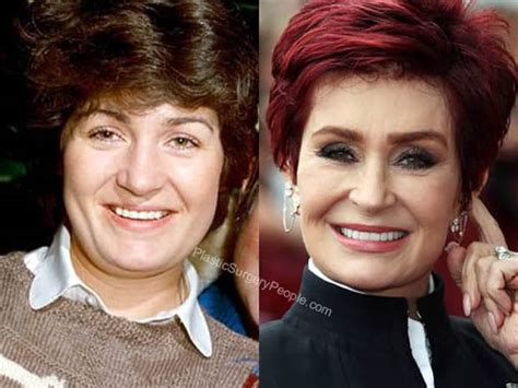 Sharon Osbourne Before And After