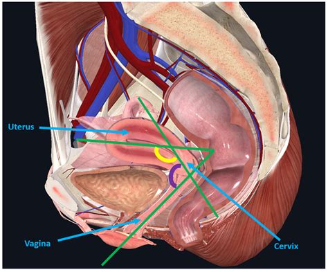 Vacío Distorsión Chip Bladder Uterus Anatomy Collar Desconocido Indirecto