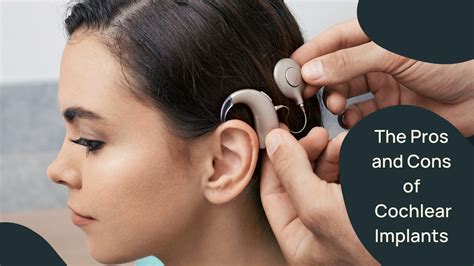 Pros And Cons Of Cochlear Implants