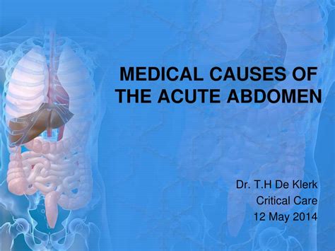 Ppt Medical Causes Of The Acute Abdomen Powerpoint