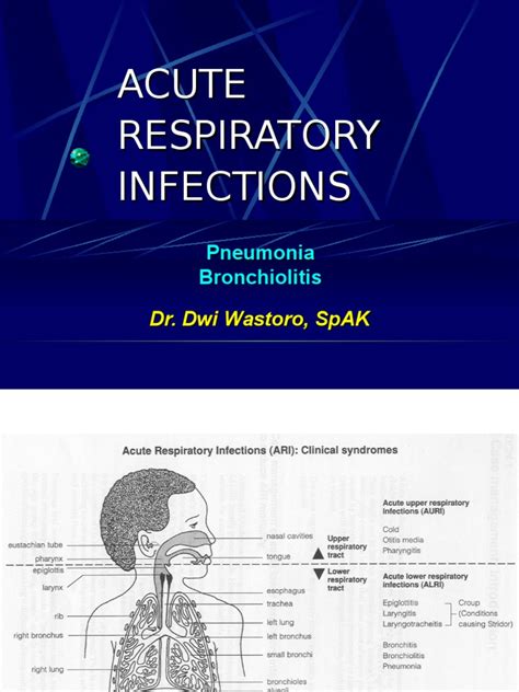 Acute Respiratory Infectionppt Pneumonia Microbiology