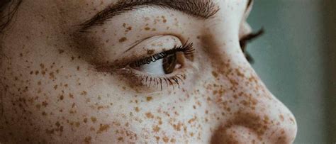 What Causes Freckles On The Human Body Bbc Science Focus Magazine