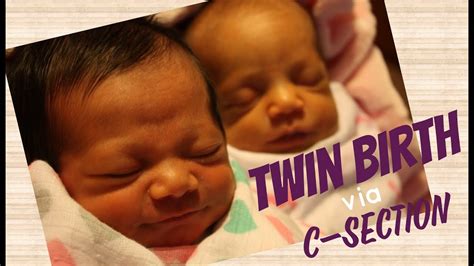 Twin Birth Via C Section Youtube