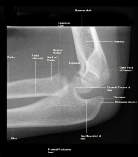 174 Best X Ray Images On Pinterest Radiology Anatomy