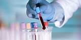 Images of Blood Test Labs Without Doctor