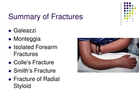 Ppt Forearm And Wrist Fractures Powerpoint Presentation Free