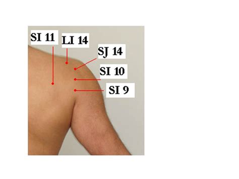 59 Frozen Shoulder And Acupuncture Treatment Jun Xu Md Rmac Greenwich Ct