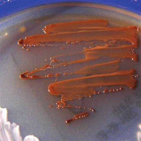 13 Cryptococcus Neoformans Cultured On Guizotia Abyssinica Creatinine