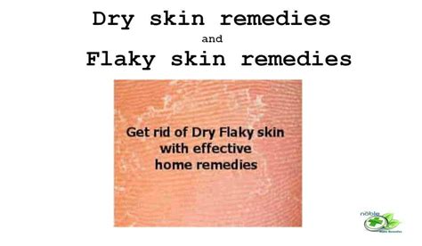 Dry Skin Remedies And Flaky Skin Remedies Noble Home Remedies