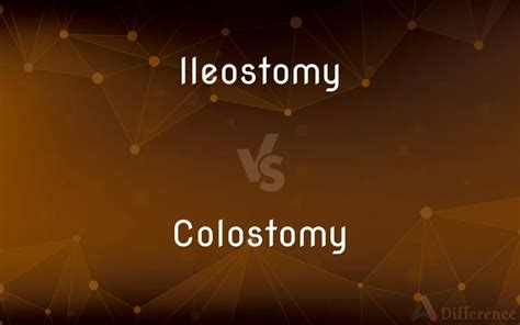 Ileostomy Vs Colostomy Whats The Difference