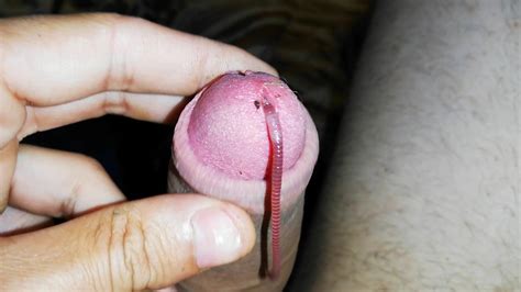 Worms In Cock Video 9