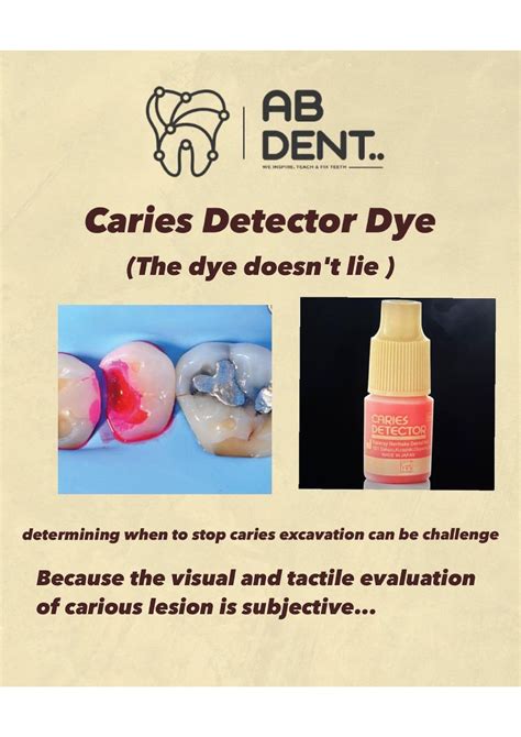Caries Detector Dye Dental Anatomy Studocu