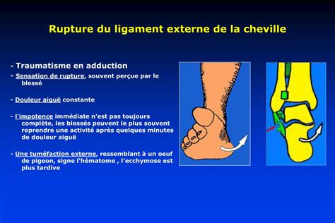 Ppt Traumatologie De La Cheville Powerpoint Presentation Free Hot Sex Picture